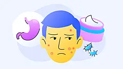Как гарантированно избавиться от прыщей за 20 дней: личный опыт