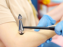 9 признаков того, что вам пора к неврологу